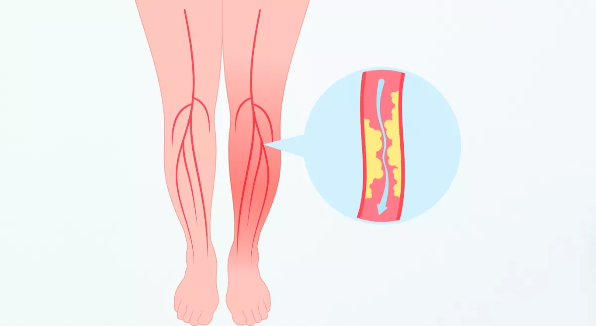 intrauterine-insemination-aster